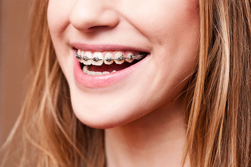 Orthodontics in Chicago